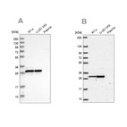 Western blot analysis using Anti-MRPL28 antibody HPA030594 (A) shows similar pattern to independent antibody HPA055589 (B).