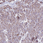 Immunohistochemical staining of human pancreas shows moderate cytoplasmic granular positivity in exocrine glandular cells.
