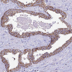 Immunohistochemical staining of human prostate shows strong cytoplasmic granular positivity in glandular cells.