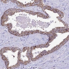 Immunohistochemical staining of human prostate shows strong cytoplasmic granular positivity in glandular cells.