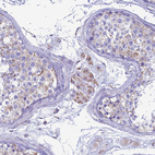Immunohistochemical staining of human testis shows moderate cytoplasmic granular positivity in cells in seminiferous ducts and leydig cells.