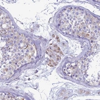 Immunohistochemical staining of human testis shows moderate cytoplasmic granular positivity in cells in seminiferous ducts and leydig cells.