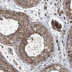 Immunohistochemical staining of human testis shows strong cytoplasmic granular positivity in seminiferous ducts and leydig cells.