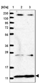 Anti-NDUFA2 Antibody