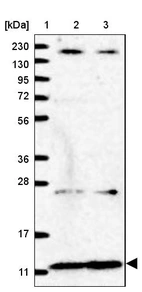 Lane 1: Marker [kDa] 230, 130, 95, 72, 56, 36, 28, 17, 11_br/_Lane 2: Human cell line RT-4_br/_Lane 3: Human cell line U-251MG sp