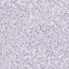 Immunohistochemical staining of human liver shows no positivity in hepatocytes as expected.