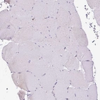 Immunohistochemical staining of human skeletal muscle shows no positivity in myocytes as expected.