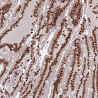 Immunohistochemical staining of human duodenum shows strong nuclear positivity in glandular cells.