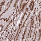 Immunohistochemical staining of human duodenum shows strong nuclear positivity in glandular cells.