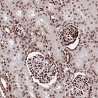 Immunohistochemical staining of human kidney shows strong nuclear positivity in cells in glomeruli and nucleus/nucleus membranous positivity in cells in tubules.