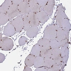 Immunohistochemical staining of human skeletal muscle shows strong nuclear positivity in myocytes.