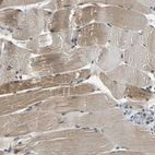 Immunohistochemical staining of human skeletal muscle shows moderate cytoplasmic-nuclear positivity in myocytes.