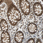 Immunohistochemical staining of human rectum shows moderate cytoplasmic-nuclear positivity in glandular cells.