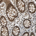 Immunohistochemical staining of human rectum shows moderate cytoplasmic-nuclear positivity in glandular cells.