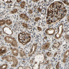 Immunohistochemical staining of human kidney shows strong cytoplasmic-nuclear positivity in cells in glomeruli and cells in tubules.