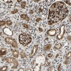 Immunohistochemical staining of human kidney shows strong cytoplasmic-nuclear positivity in cells in glomeruli and cells in tubules.
