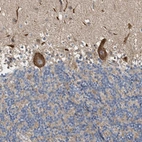 Immunohistochemical staining of human cerebellum shows strong cytoplasmic-membranous positivity in Purkinje cells.