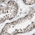Immunohistochemical staining of human testis shows moderate cytoplasmic-membranous positivity in cells in seminiferous ducts with moderate nuclear positivity.