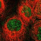 Immunofluorescent staining of human cell line A-431 shows localization to nucleoplasm & cytosol.