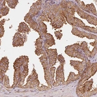 Immunohistochemical staining of human prostate shows moderate cytoplasmic granular positivity in glandular cells.