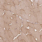 Immunohistochemical staining of human skeletal muscle shows moderate cytoplasmic granular positivity in myocytes.