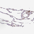 Immunohistochemical staining of human lung shows moderate cytoplasmic positivity in macrophages.