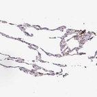 Immunohistochemical staining of human lung shows moderate cytoplasmic positivity in macrophages.