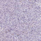 Anti-PSMB9 Antibody