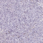 Immunohistochemical staining of human pancreas shows no positivity in exocrine glandular cells as expected.