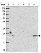 Lane 1: Marker [kDa] 250, 130, 95, 72, 55, 36, 28, 17, 10_br/_Lane 2: Human cell line RT-4_br/_Lane 3: Human cell line U-251MG sp_br/_Lane 4: Human plasma (IgG/HSA depleted)_br/_Lane 5: Human liver tissue_br/_Lane 6: Human tonsil tissue