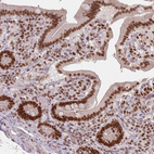 Immunohistochemical staining of human rectum shows strong nuclear/nuclear membranous positivity in glandular cells.