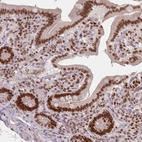 Immunohistochemical staining of human rectum shows strong nuclear/nuclear membranous positivity in glandular cells.