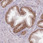 Immunohistochemical staining of human prostate shows moderate nuclear/nuclear membranous positivity in glandular cells.
