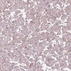 Immunohistochemical staining of human heart muscle shows weak nuclear positivity in hematopoietic cells.