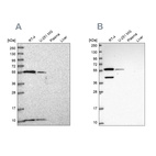 Western blot analysis using Anti-NUP50 antibody HPA047162 (A) shows similar pattern to independent antibody HPA048328 (B).