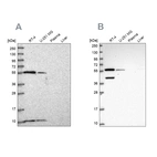 Western blot analysis using Anti-NUP50 antibody HPA047162 (A) shows similar pattern to independent antibody HPA048328 (B).