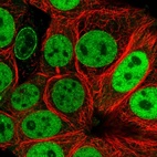 Immunofluorescent staining of human cell line MCF7 shows localization to nucleoplasm & nuclear membrane.