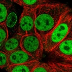 Immunofluorescent staining of human cell line MCF7 shows localization to nucleoplasm & nuclear membrane.