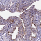 Immunohistochemical staining of human fallopian tube shows strong positivity in cytoplasm granular in glandular cells.