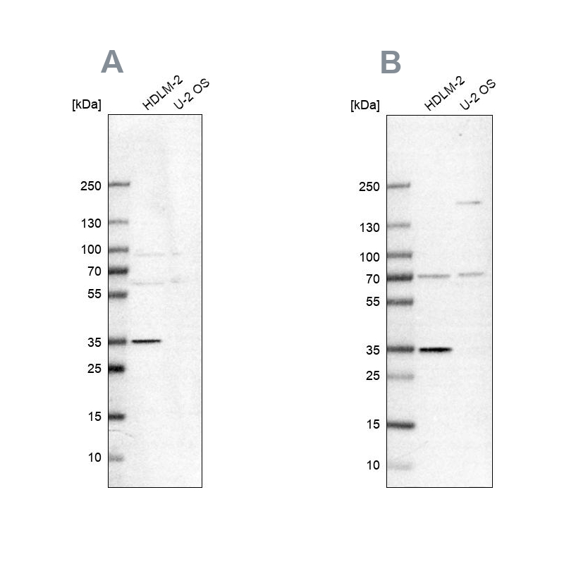Anti-TTC19 Antibody