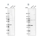 Anti-TTC19 Antibody