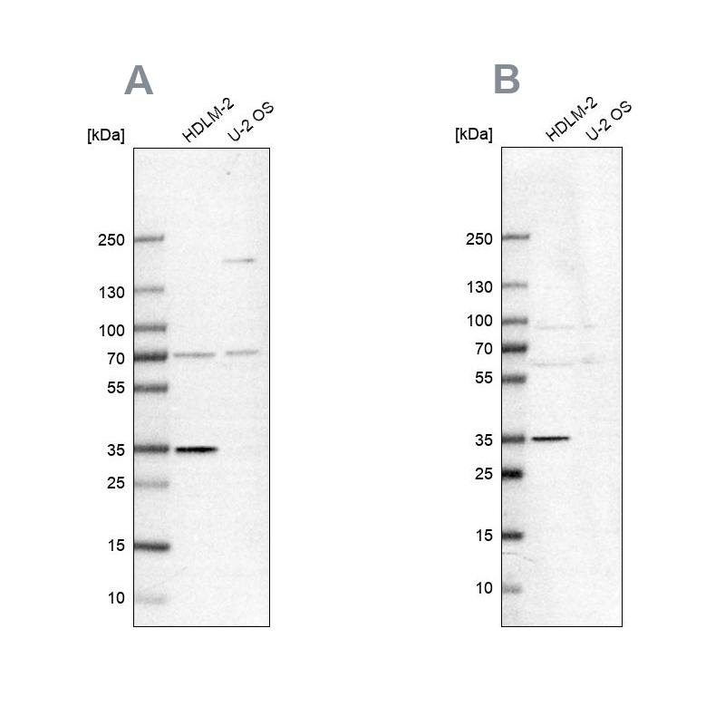Anti-TTC19 Antibody