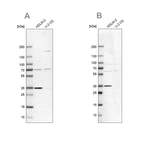 Anti-TTC19 Antibody