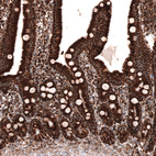 Anti-TUFM Antibody