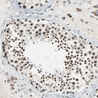 Immunohistochemical staining of human testis shows strong nuclear positivity in cells in seminiferous ducts.