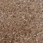 Immunohistochemical staining of human liver shows strong nuclear and cytoplasmic positivity in hepatocytes.