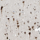 Immunohistochemical staining of human cerebral cortex shows strong nuclear positivity in neurons.