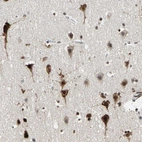 Immunohistochemical staining of human cerebral cortex shows strong nuclear positivity in neurons.