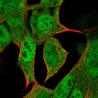 Immunofluorescent staining of human cell line HEK 293 shows positivity in nucleus & cytoplasm.
