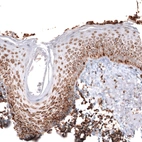 Immunohistochemical staining of human skin shows moderate to strong granular cytoplasmic positivity in squamous epithelial cells.
